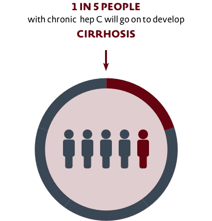 cirrhosis-and-hep-c